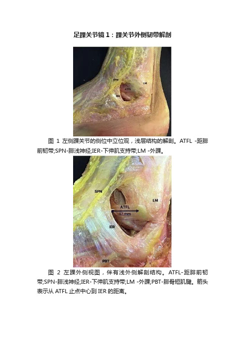 足踝关节镜1：踝关节外侧韧带解剖