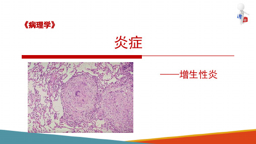 炎症的类型—增生性炎(病理学课件)