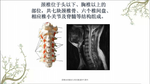 颈椎MRI解剖与常用数据PPT课件