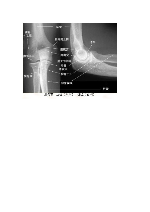 x光片精细图解文档