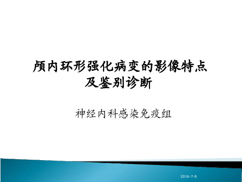 神内教学查房-颅内环形强化病变的影像特点