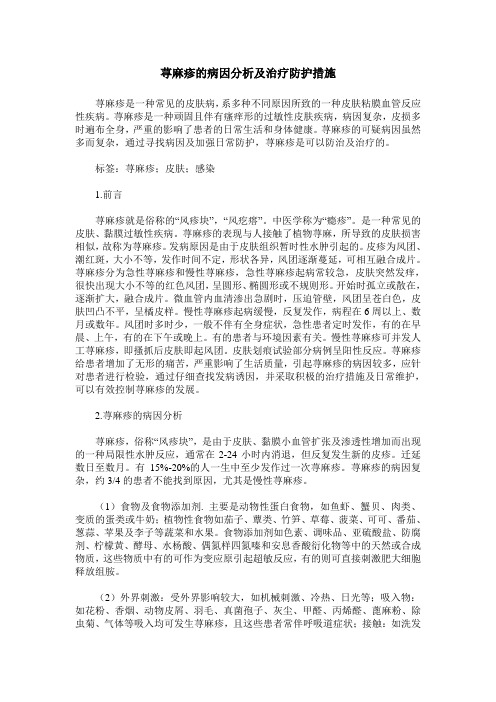 荨麻疹的病因分析及治疗防护措施