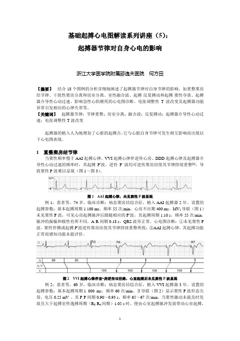 基础起搏心电图解读之五起搏器节律对自身心电的影响