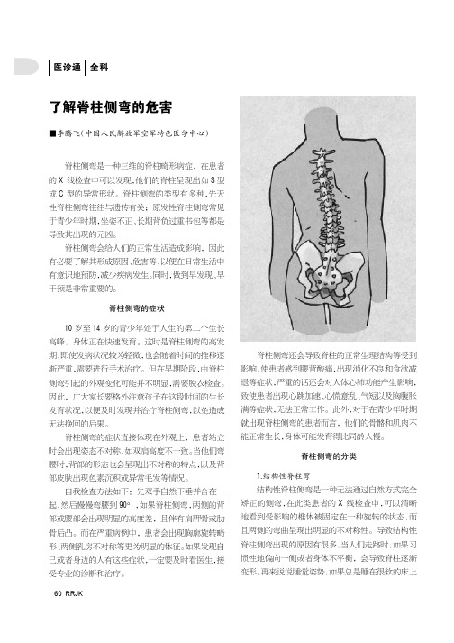 了解脊柱侧弯的危害