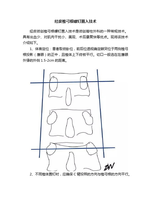 经皮椎弓根螺钉置入技术