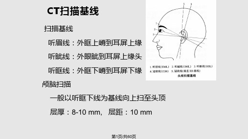 脑部CT讲座PPT课件