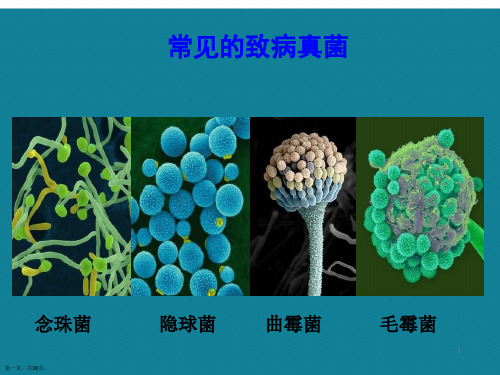 (优选)从实践看呼吸科肺部真菌感染第三军医大学西南医院呼吸科