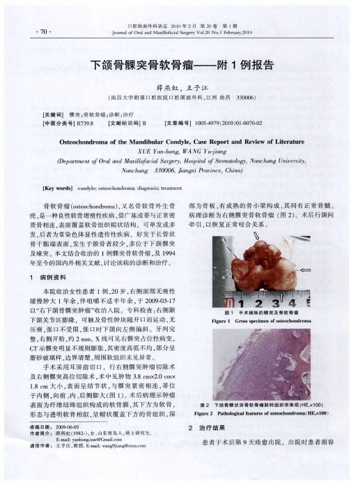 下颌骨髁突骨软骨瘤——附1例报告