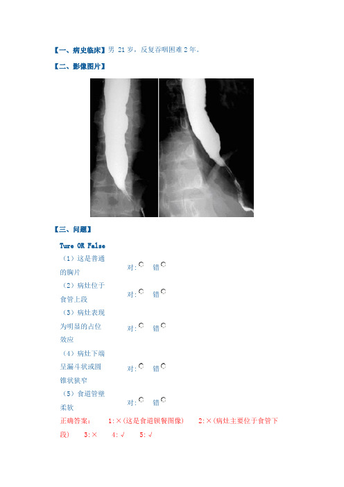 消化系统医学影像病例讨论