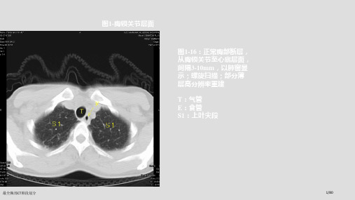 最全胸部CT肺段划分