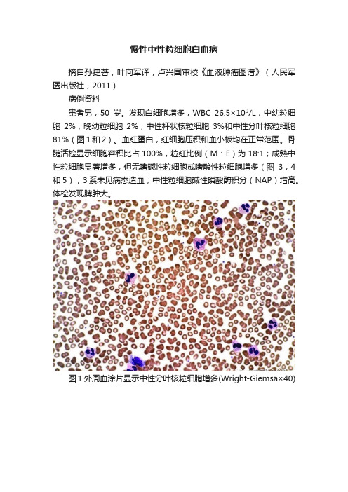 慢性中性粒细胞白血病