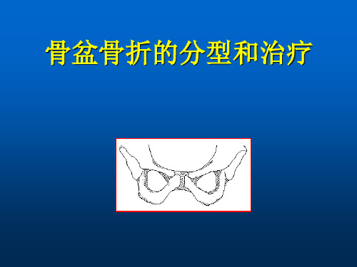 (医学课件)骨盆骨折的分型和治疗ppt演示课件