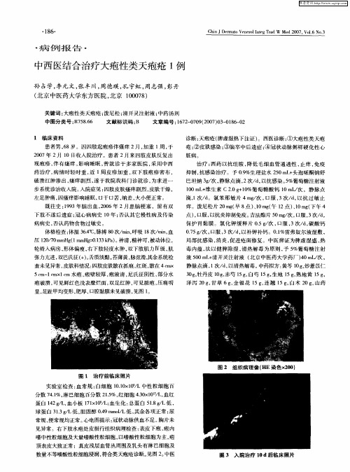 中西医结合治疗大疱性类天疱疮1例