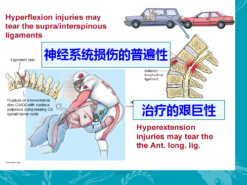 脊髓损伤的修复与再生  ppt课件