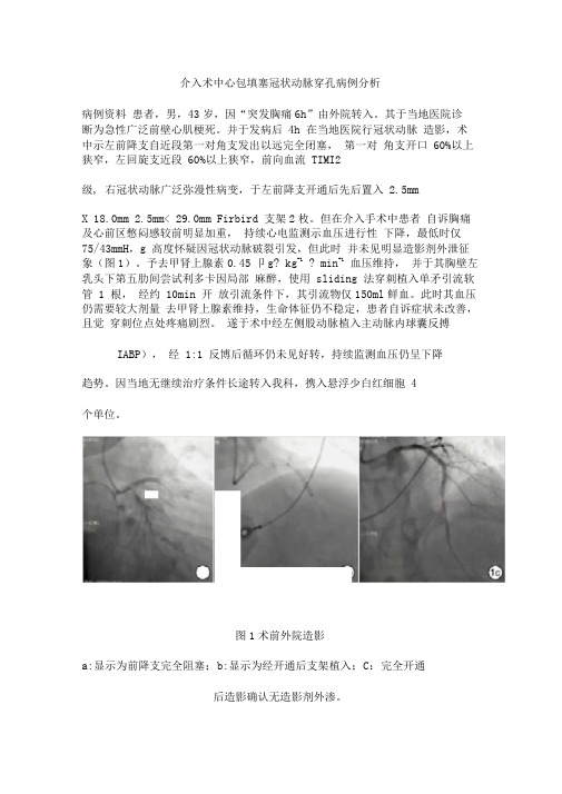 介入术中心包填塞冠状动脉穿孔病例分析