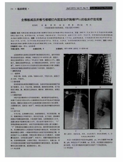 全椎板减压并椎弓根螺钉内固定治疗胸椎OPLL的临床疗效观察