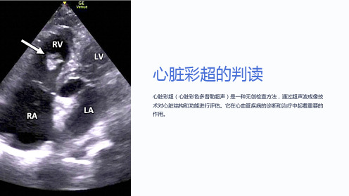 心脏彩超的判读