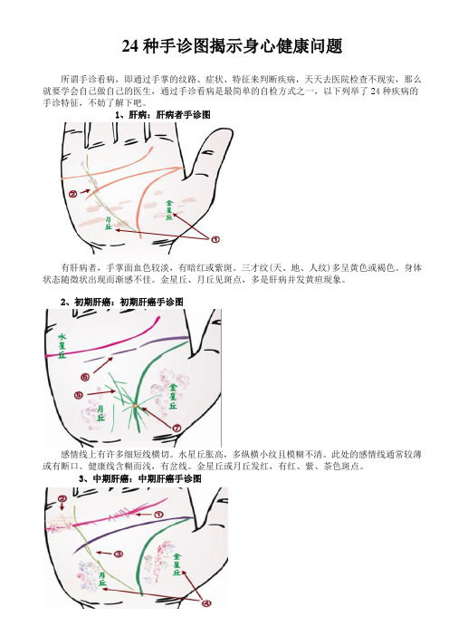 24种手诊图揭示身心健康问题