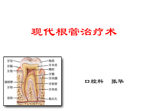 现代根管治疗术