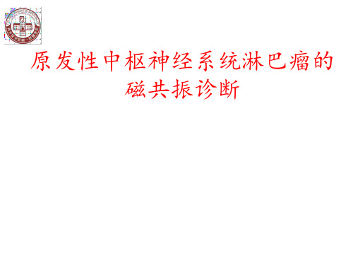 医学交流课件：原发性中枢神经系统淋巴瘤的磁共振诊断