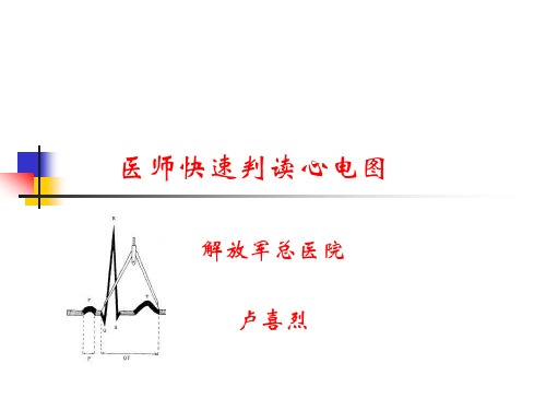 医生快速判读心电PPT课件