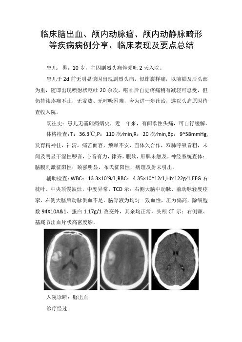 临床脑出血颅内动脉瘤颅内动静脉畸形等疾病病例分享临床表现及要点总结