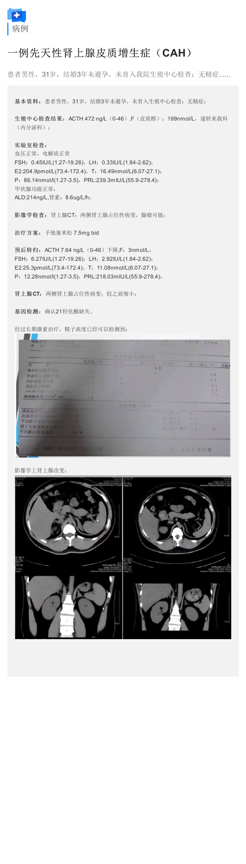 病例分析：一例先天性肾上腺皮质增生症((CAH))