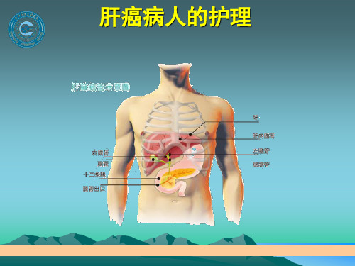 肝癌病人的护理ppt【54页】