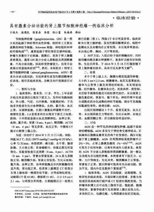 具有激素分泌功能的肾上腺节细胞神经瘤一例临床分析