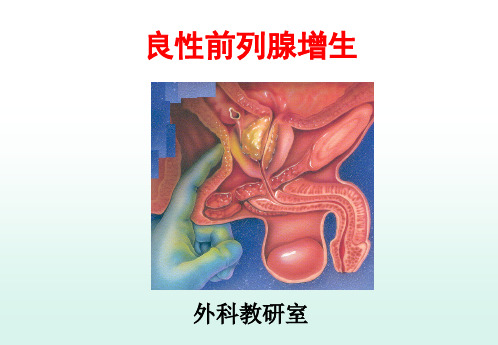 《良性前列腺增生》PPT课件