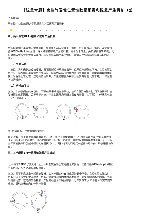 【眩晕专题】良性阵发性位置性眩晕眼震和眩晕产生机制（2）