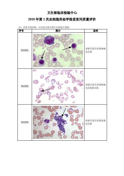 卫生部形态学质控系列---2010年第2次血细胞形态学检查室间质量评价图片