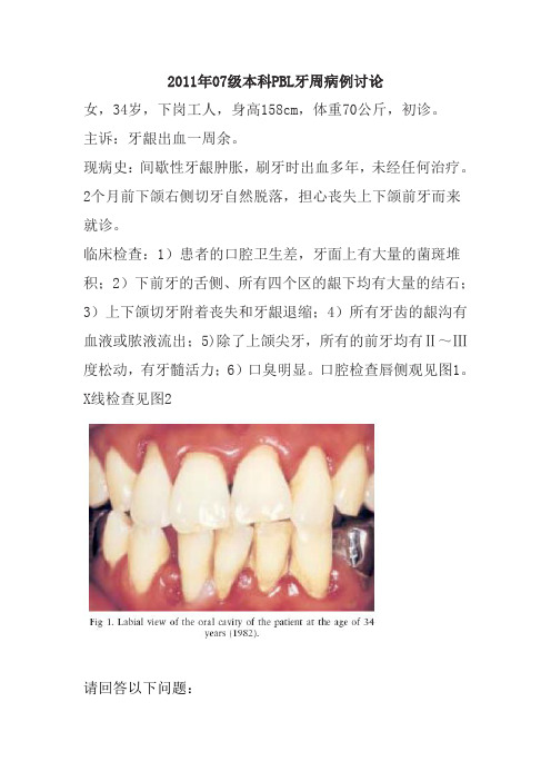 2011年PBL牙周病例讨论