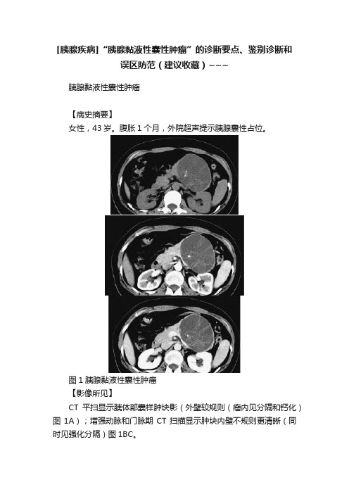 [胰腺疾病]“胰腺黏液性囊性肿瘤”的诊断要点、鉴别诊断和误区防范（建议收藏）~~~