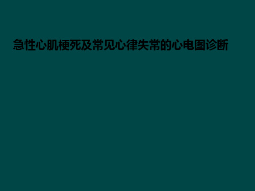 急性心肌梗死心电图及常见心律失常心电图ppt课件