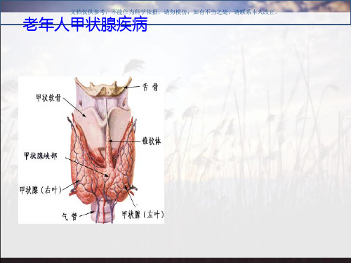 老年人甲状腺疾病课件