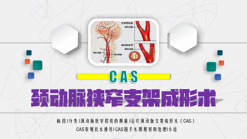 颈动脉狭窄支架成形术CAS