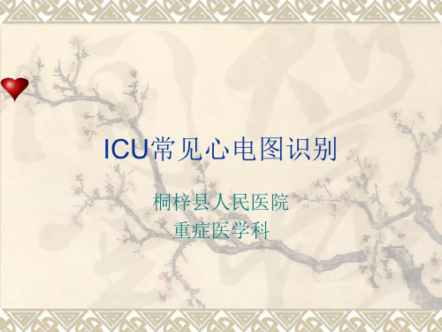 ICU常见心电图识别