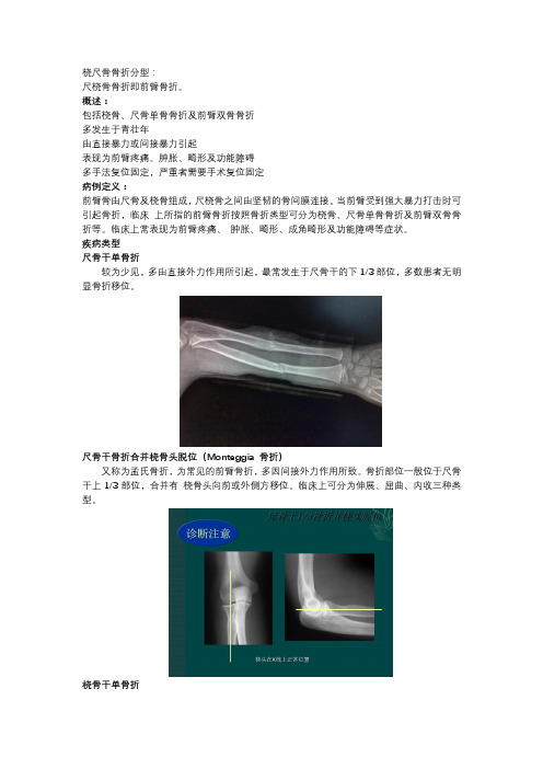 桡尺骨骨折分型