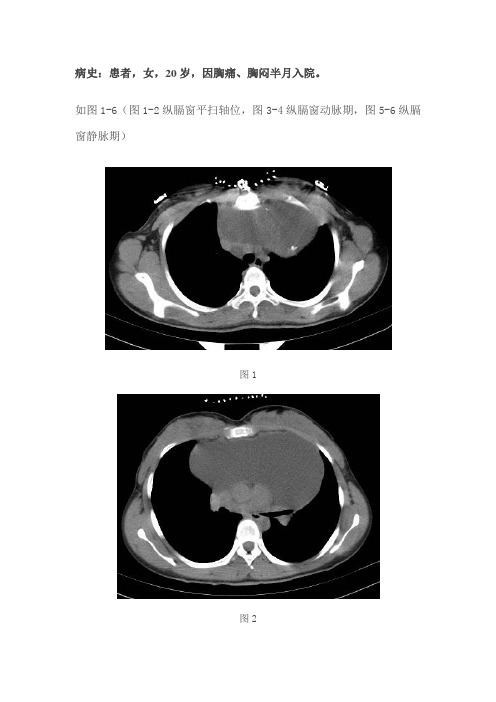 前纵隔囊性不均质占位病变--囊性畸胎瘤