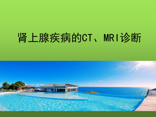 肾上腺疾病的CT、MRI诊断