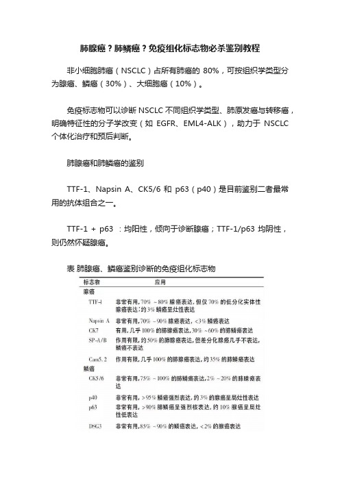 肺腺癌？肺鳞癌？免疫组化标志物必杀鉴别教程