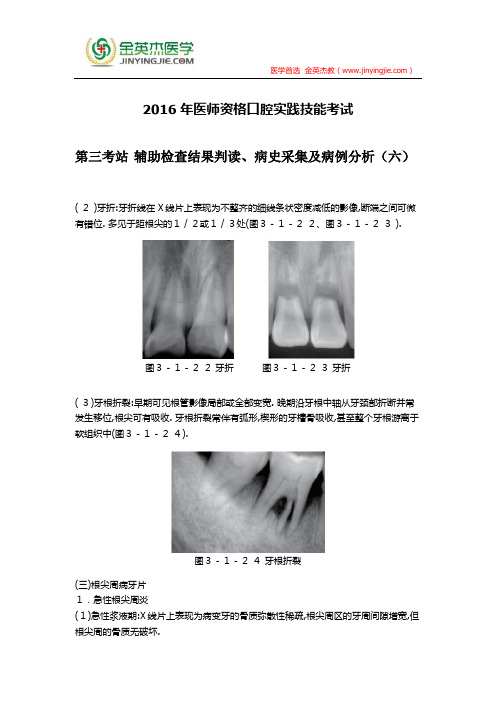 2016年医师资格口腔实践技能考试第三考站 辅助检查结果判读、病史采集及病例分析(六)