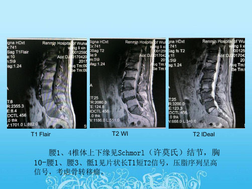 MRI诊断入门病例(二)