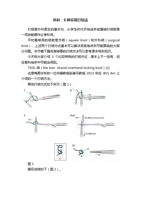 外科：3种实用打结法