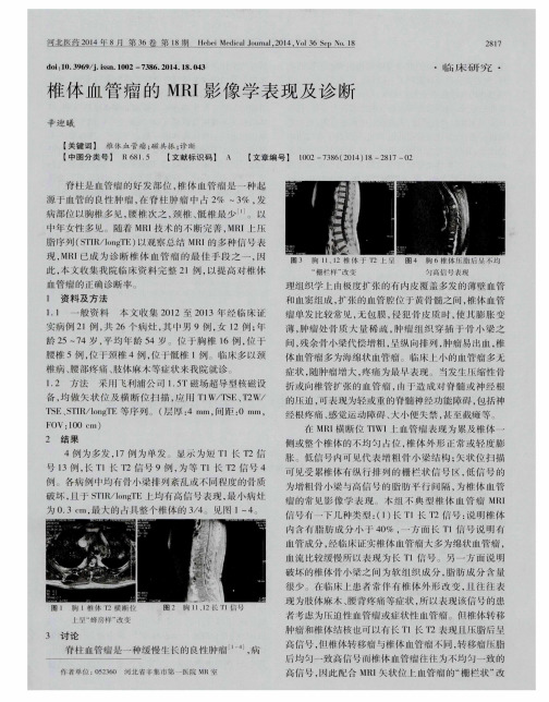 椎体血管瘤的MRI影像学表现及诊断