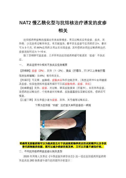 NAT2慢乙酰化型与抗结核治疗诱发的皮疹过敏反应相关