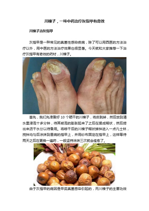 川楝子，一味中药治疗灰指甲有奇效