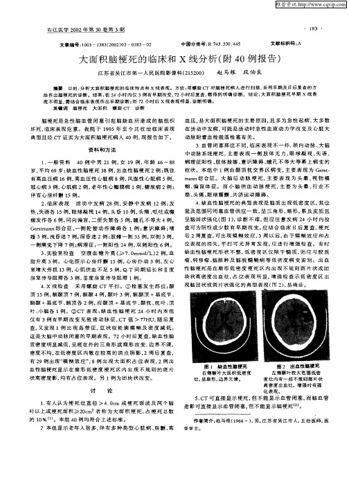 大面积脑梗死的临床和X线分析(附40例报告)