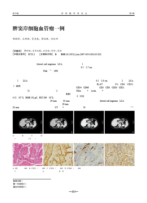 脾窦岸细胞血管瘤一例